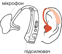 слуховий апарат