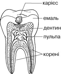 карієс