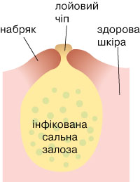 вугрі