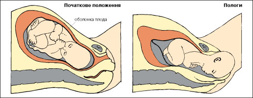 пологи